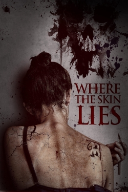 Where the Skin Lies-online-free
