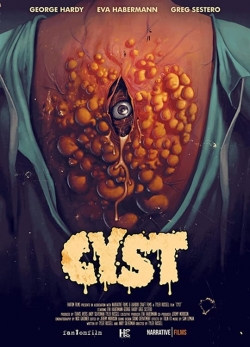 Cyst-online-free